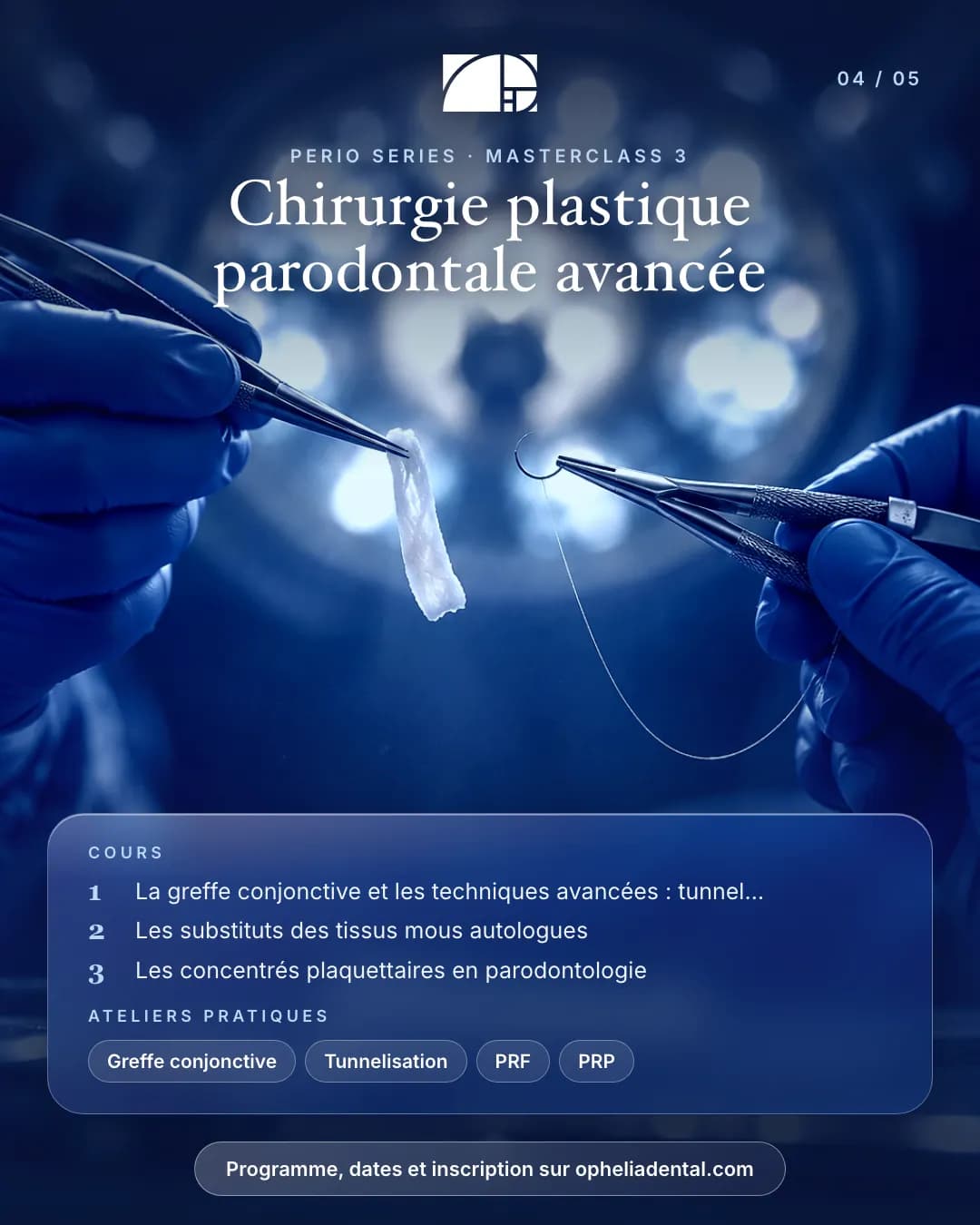 Masterclass 3, chirurgie plastique parodontale avancée. Cours : greffe conjonctive et tunnelisation ; substituts des tissus mous autologues ; concentrés plaquettaires. Ateliers : greffe conjonctive, tunnelisation, PRF, PRP
