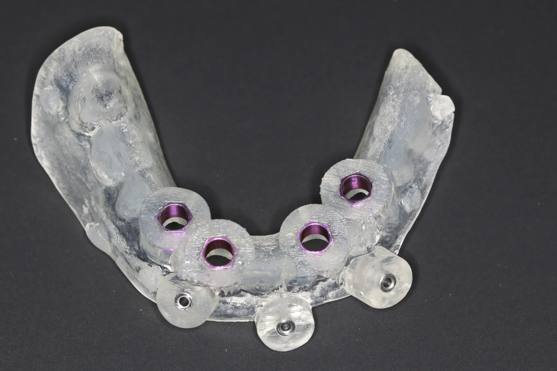 Guide chirurgical conçu en CFAO, à douilles métalliques, sur fond neutre